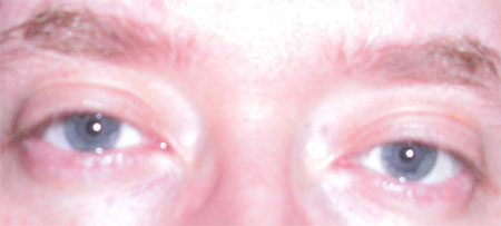 Behind Blue Eyes